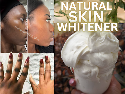 #ad Dark Skin Whitening Lightening Blemish Spot Bleaching Cream Hyperpigmentation $12.00