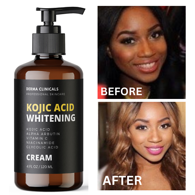 #ad Dark Skin Whitening Dark spot Brightening Bleaching Lightening Face body Cream $18.99