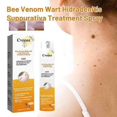 #ad Bee Ven om Wart and Tags Removal Treatment Spray 20ml $6.89