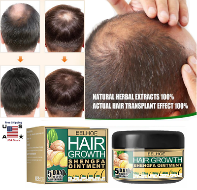 #ad 3× Ginger Hair Growth Cream Hair Regrowth Hair Repair Anti Germinal Hair Loss US $9.35
