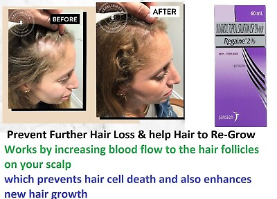 #ad Regaine Minoxidiil 2% Scalp Solution Hair Loss for Women Regular Strength 60ml $24.29