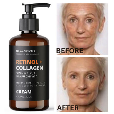 #ad Retinol Collagen Hyaluronic Acid Vitamin C AntiAging Wrinkle Serum Cream 4oz $17.99