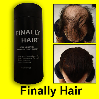 #ad 27.5g Keratin Hair Loss Fiber Building Fibers Applicator Bottle Finally Hair Kit $16.91