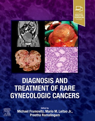 #ad Diagnosis and Treatment of Rare Gynecologic Cancers $99.74