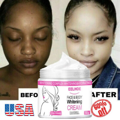 #ad Dark Skin Permanent Whitening Bleaching Cream 3 DAYS Body Lightening Brightening $8.95
