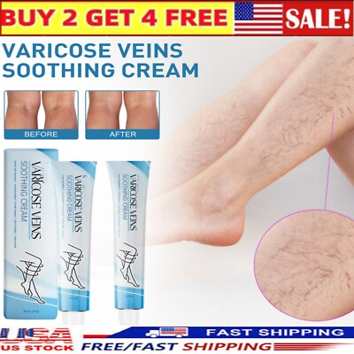 #ad Raura Varicose Veins Cream Raura Varicose Veins Treatment Cream for Legs $8.99
