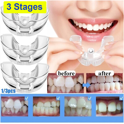 3 Stages Dental Orthodontic Teeth Corrector Braces For Adults Tooth Retainer US $13.65
