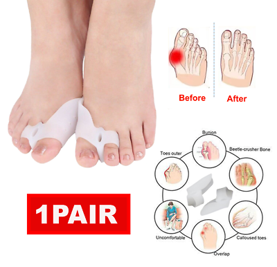 #ad 1 Pair Silicone Gel Bunion Toe Corrector Orthotics Straightener Separator Pain $4.36