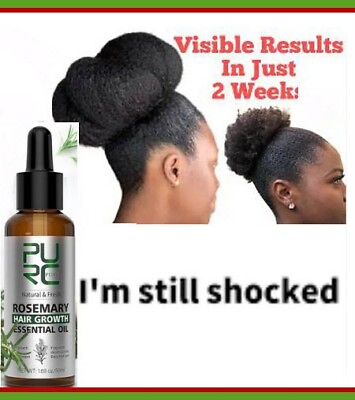 #ad 1#BEST GROWTH OIL GUARANTEE WILL GROW YOUR HAIR FASTER LONGER* $21.30