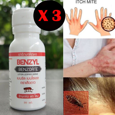 #ad X 3 SCABIES TREATMENT LOTION MITE amp; LICE Benzyl Benzoate 25% FREE TRACKING NO $29.99