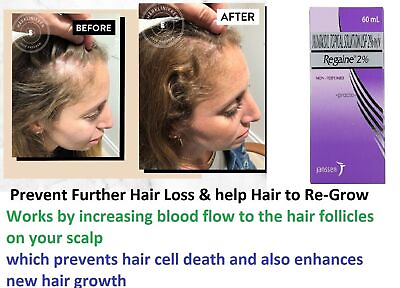 #ad Regaine Minoxidiil 2% Scalp Solution Hair Loss for Women Regular Strength 60ml $23.80