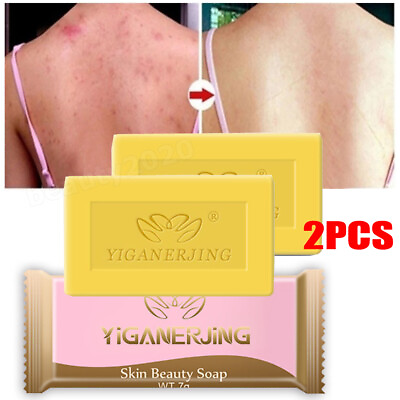 #ad 2 Pack Sulfur Soap Skin Cleaning Acne Seborrhea Anti Fungus Bath Soap Anti mite $8.45