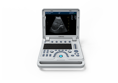 #ad Color AUltrasound Scanner Machine diagnosis of abdomen heart peripheral vessel $3749.00