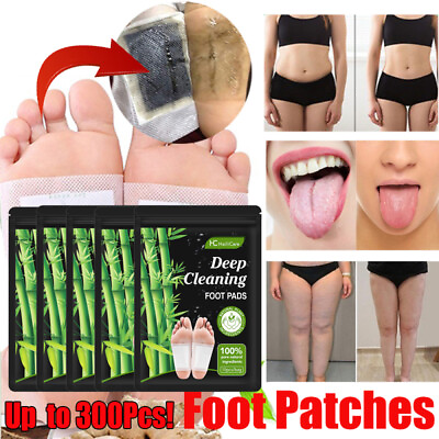 #ad 300Pcs Detox Foot Pads Ginger Extract Toxin Removal Anti Swelling Weight Patches $39.38