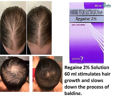 #ad Regaine Minoxidiil 2% Scalp Solution Hair Loss for Women Regular Strength 60ml $24.90